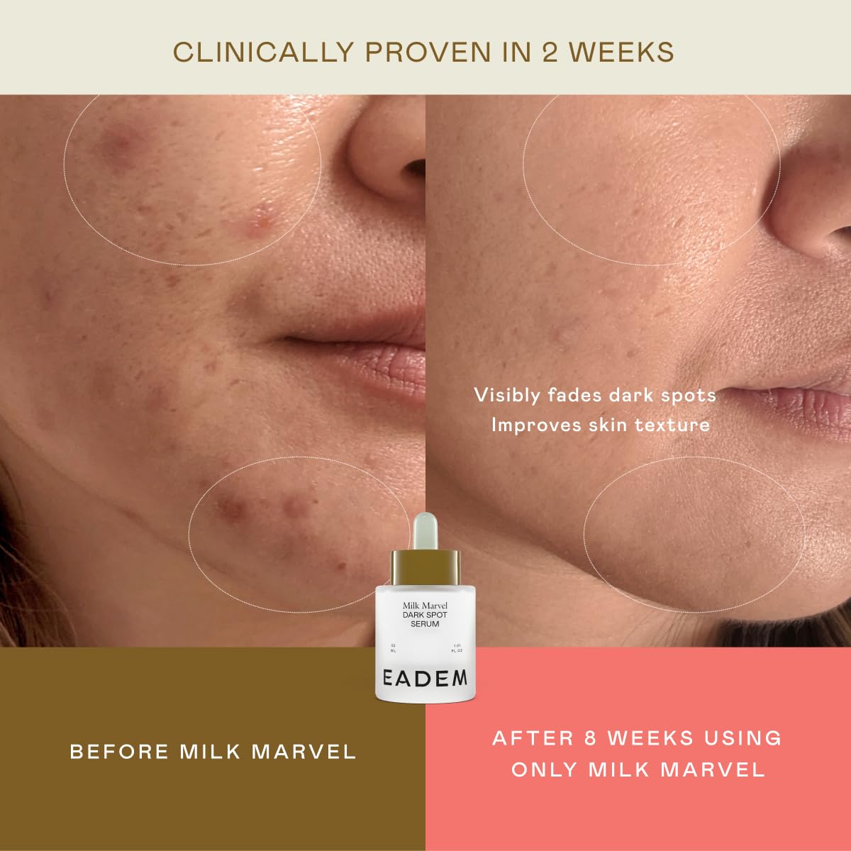 EADEM Milk Marvel Dark Spot Serum