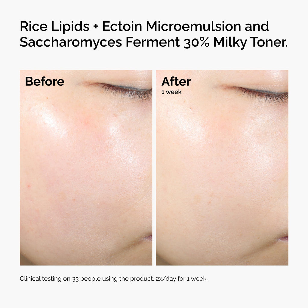 The Ordinary Rice Lipids + Ectoin Moisturizer