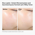 The Ordinary Rice Lipids + Ectoin Moisturizer