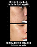 Allies of Skin Molecular Barrier Repair Cream