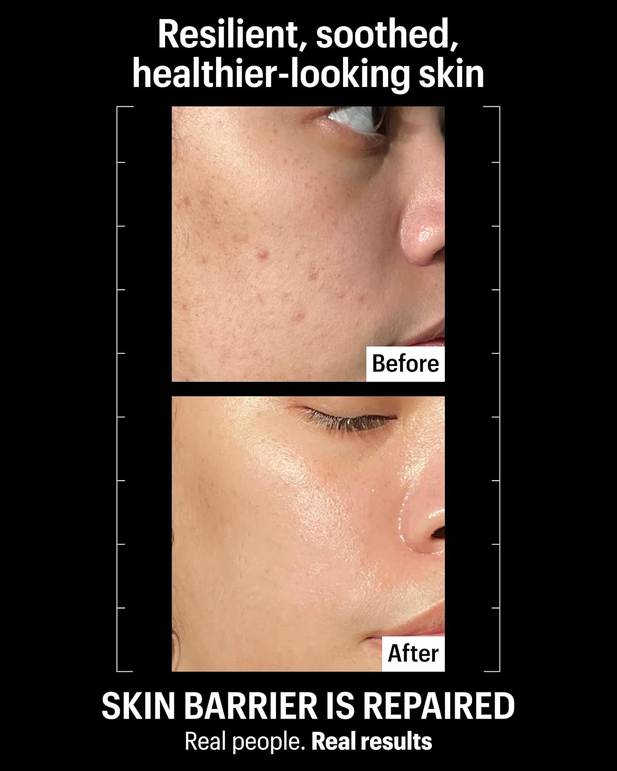 Allies of Skin Molecular Barrier Repair Cream