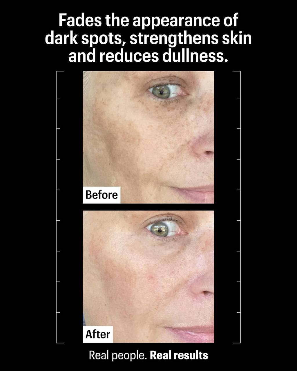 Allies of Skin Tranexamic & Arbutin Brightening Serum