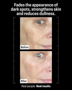 Allies of Skin Tranexamic & Arbutin Brightening Serum
