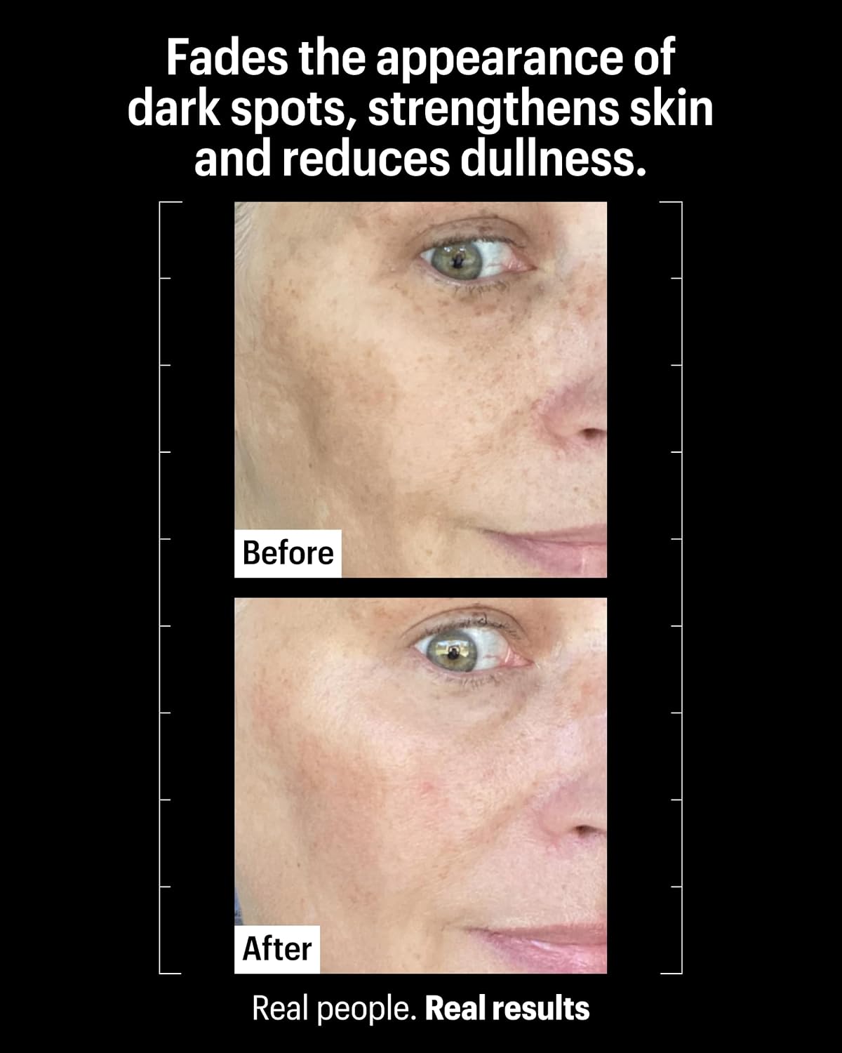 Allies of Skin Tranexamic & Arbutin Brightening Serum