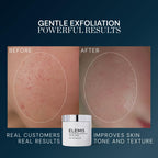 ELEMIS Dynamic Resurfacing Facial Pads