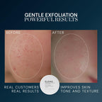 ELEMIS Dynamic Resurfacing Facial Pads