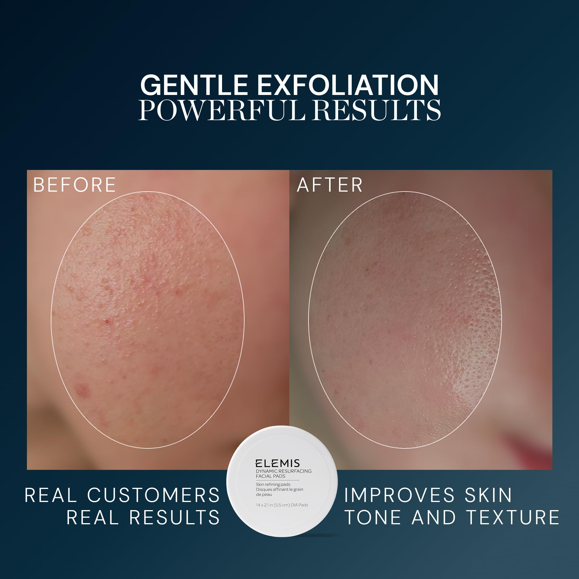 ELEMIS Dynamic Resurfacing Facial Pads