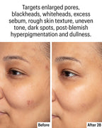 Allies of Skin Azelaic & Kojic Clarifying Serum