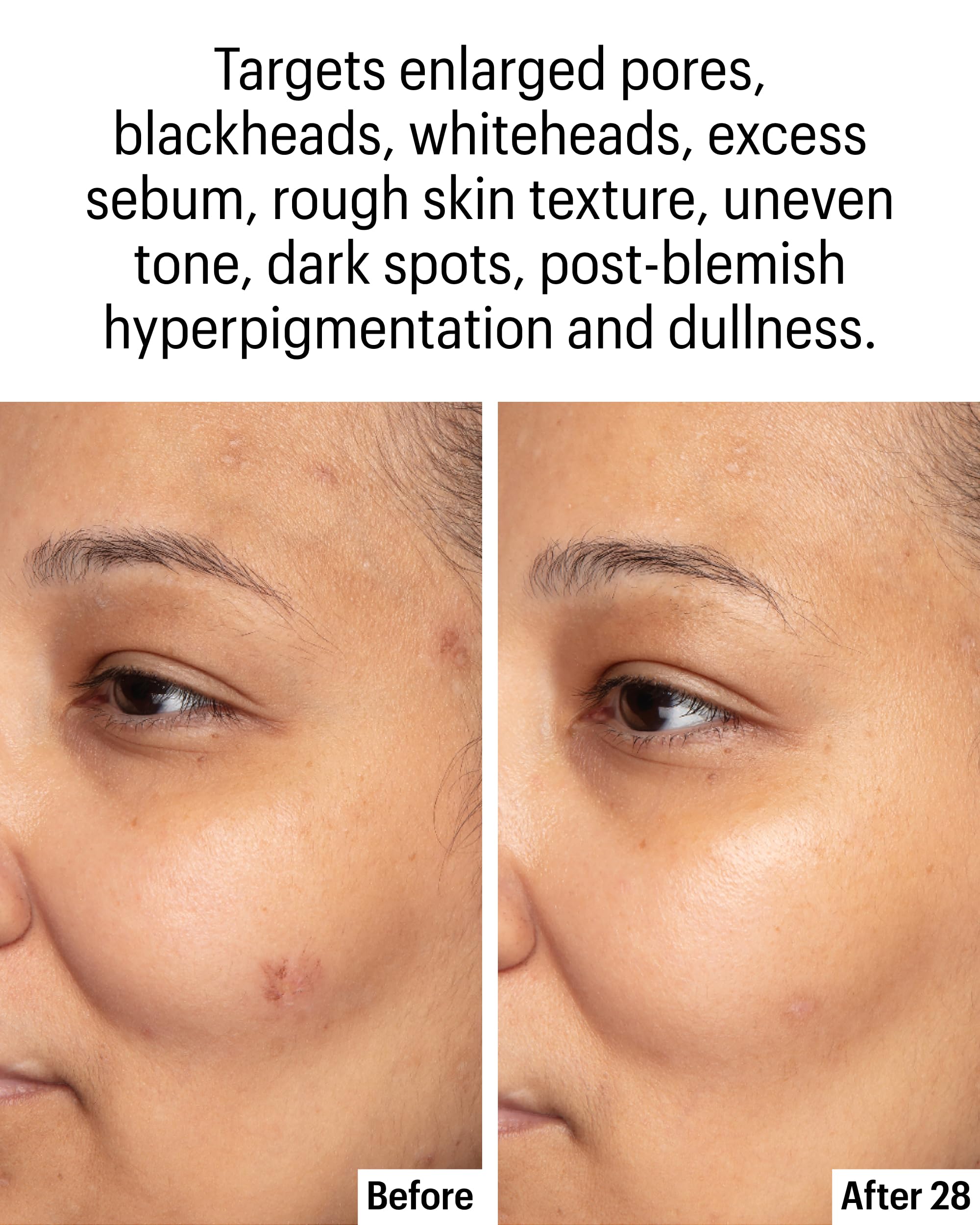 Allies of Skin Azelaic & Kojic Clarifying Serum