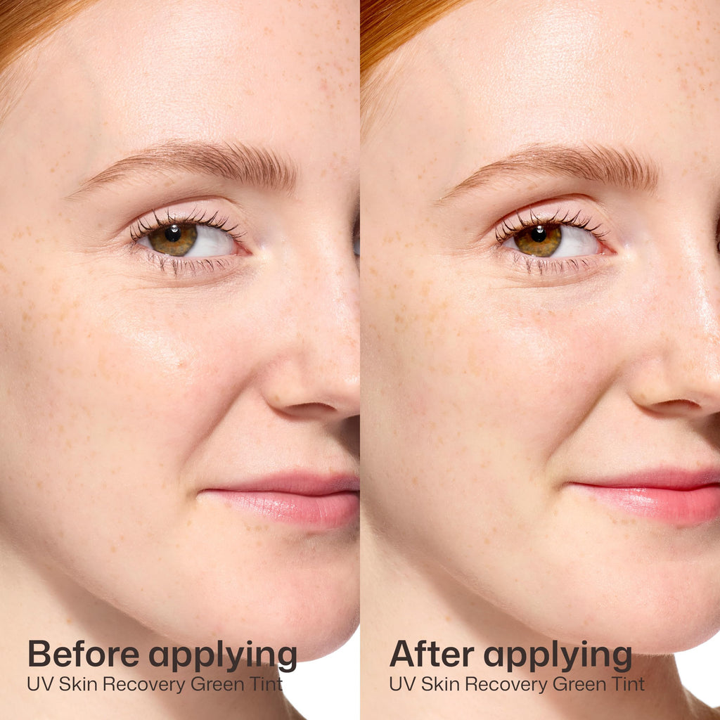 EltaMD UV Skin Recovery Sunscreen SPF 50