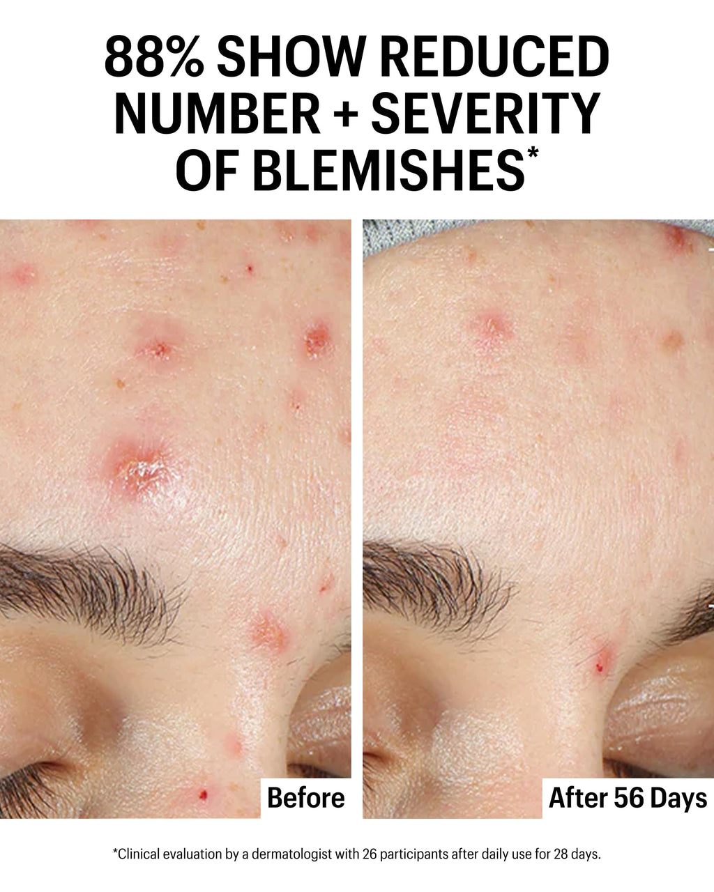 Allies of Skin Azelaic & Kojic Clarifying Serum
