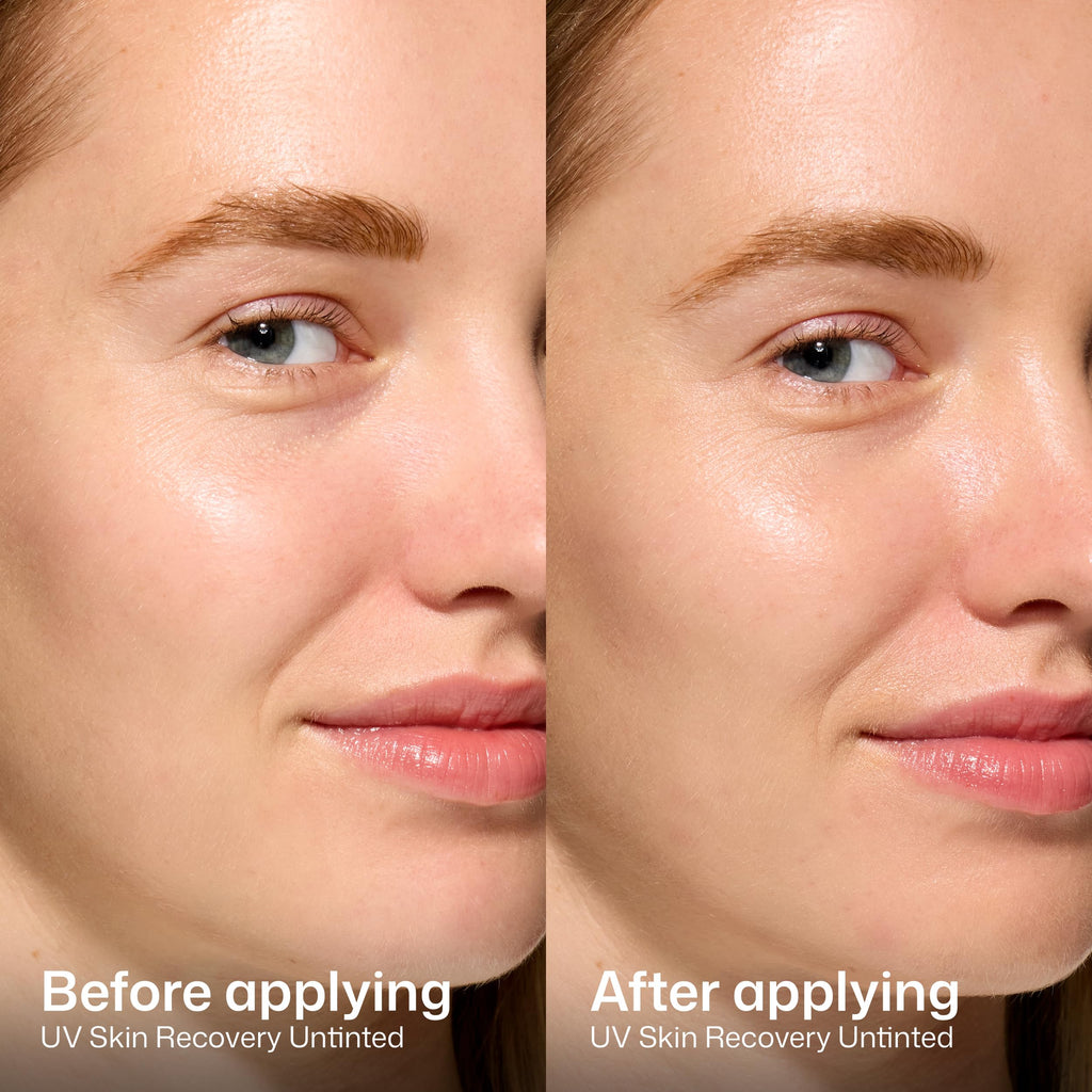 EltaMD UV Skin Recovery Sunscreen SPF 50