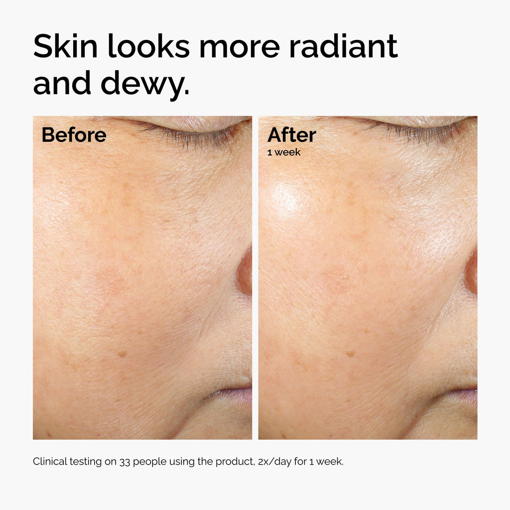 The Ordinary Rice Lipids + Ectoin Moisturizer