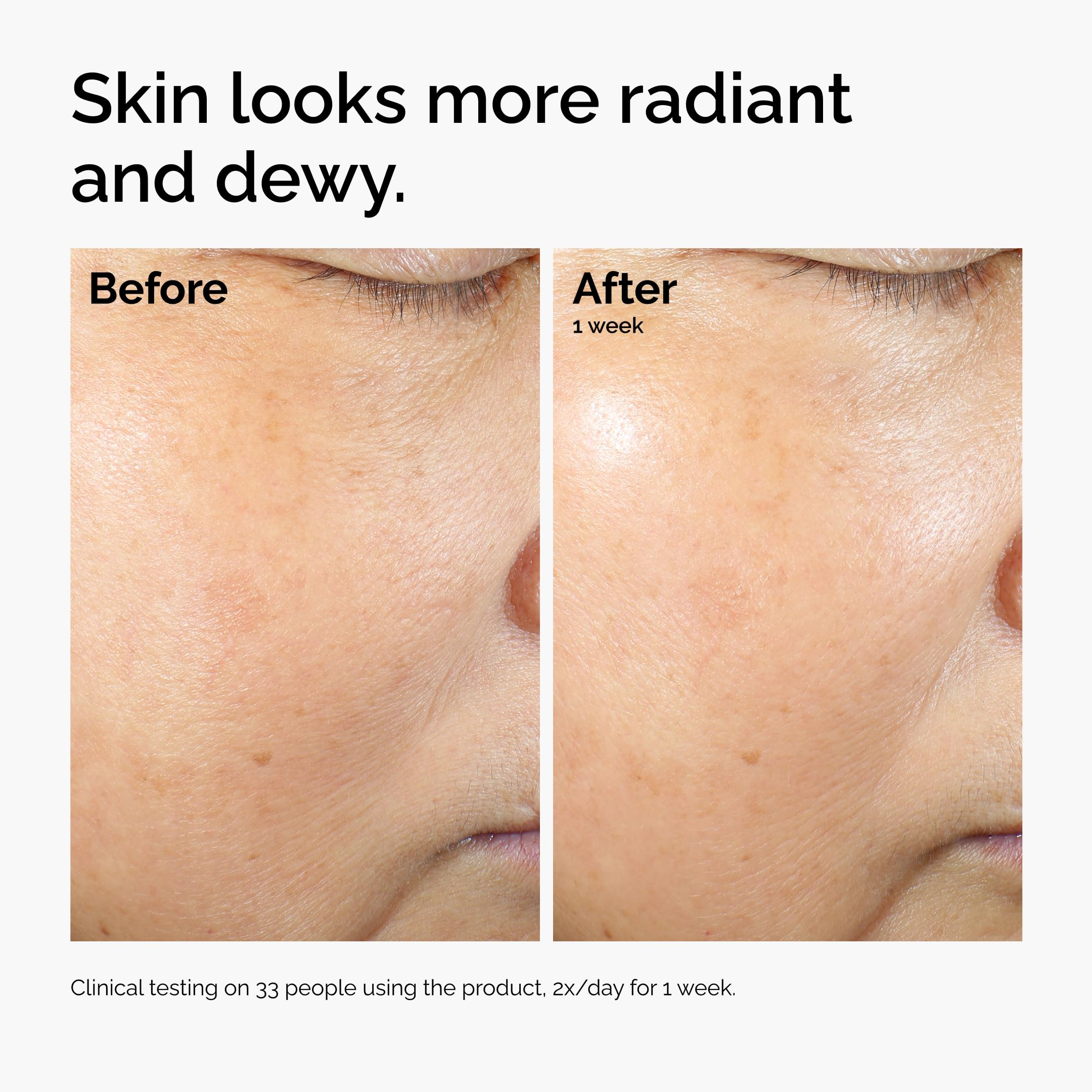 The Ordinary Rice Lipids + Ectoin Moisturizer