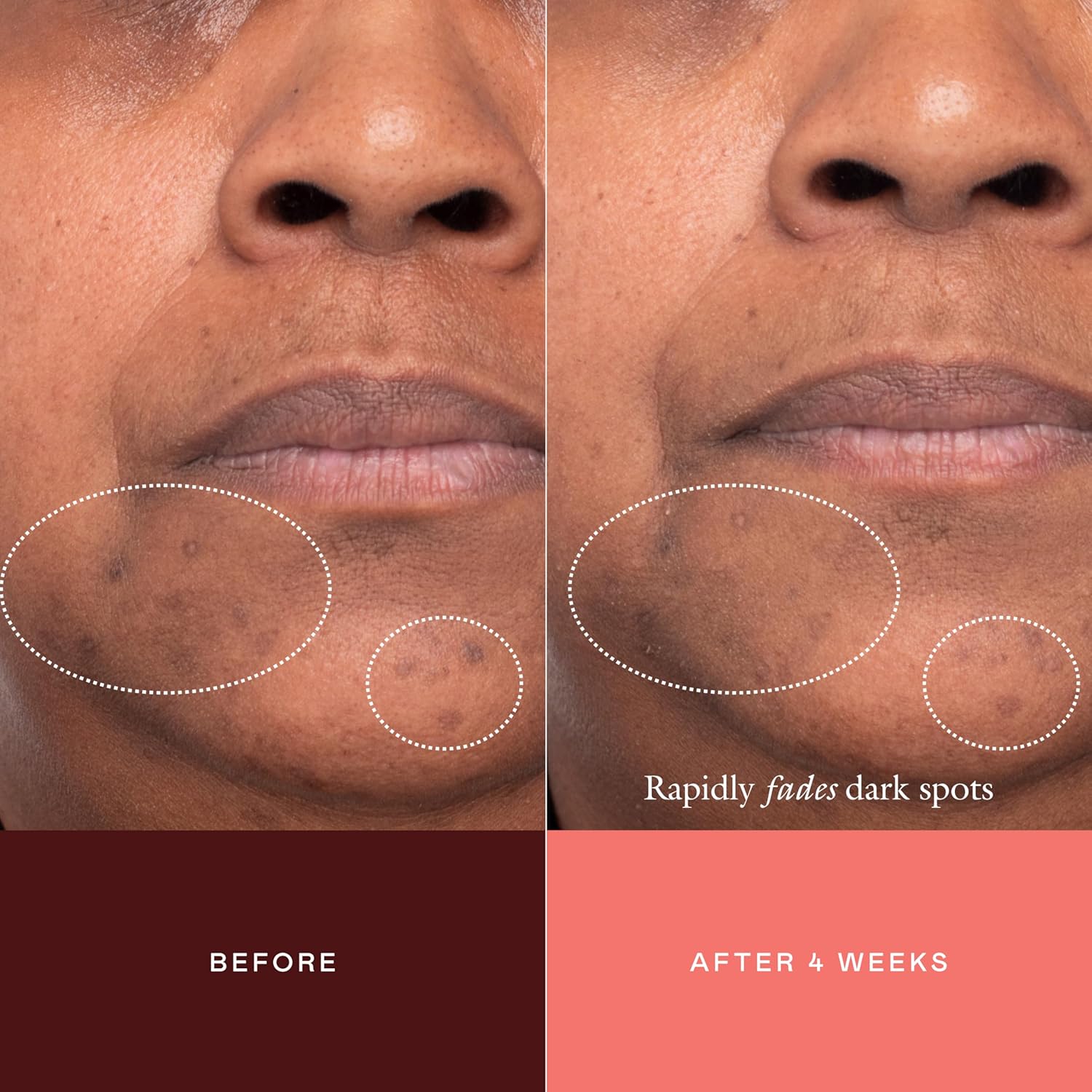 Topicals The Mark Dark Spot Concentrate