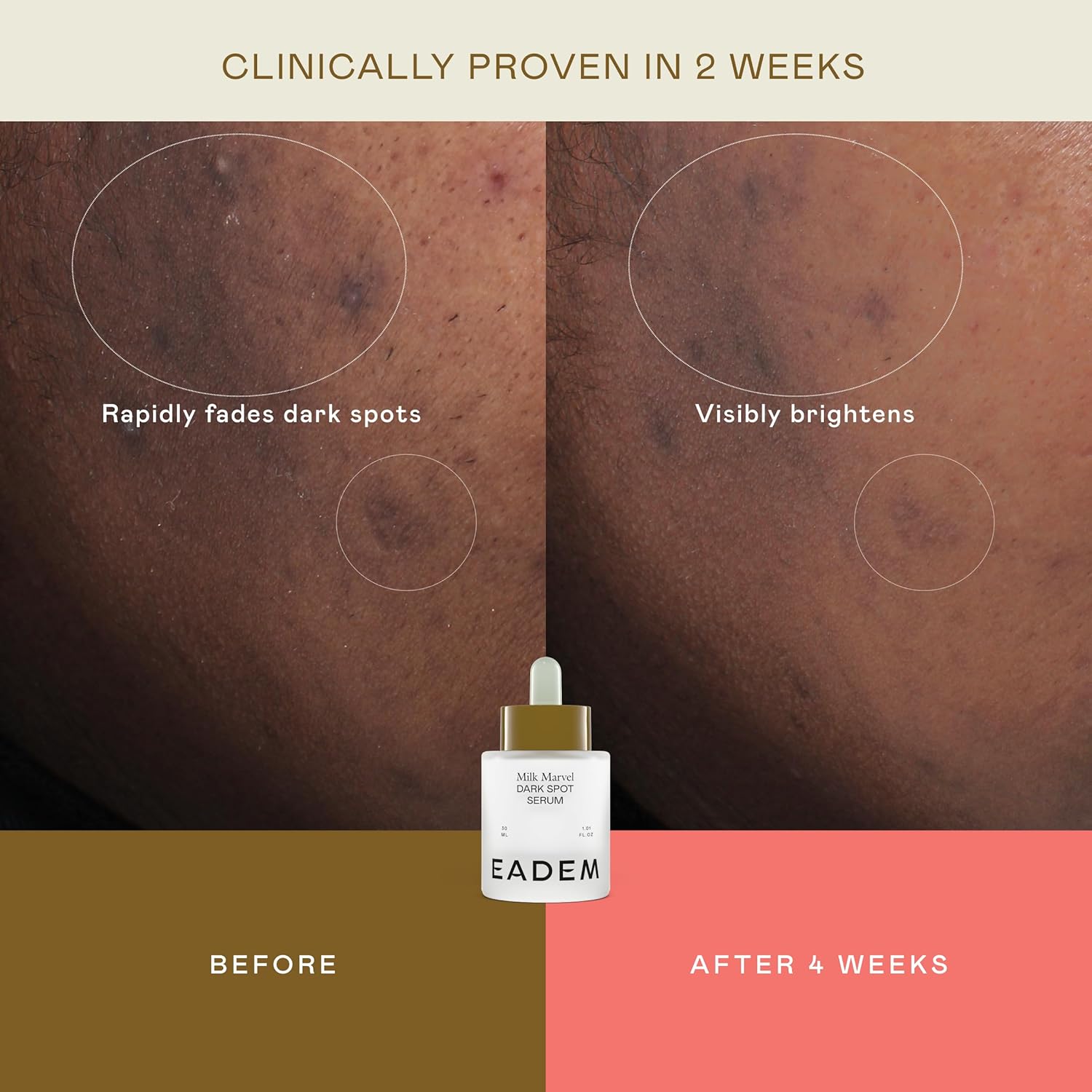 EADEM Milk Marvel Dark Spot Serum