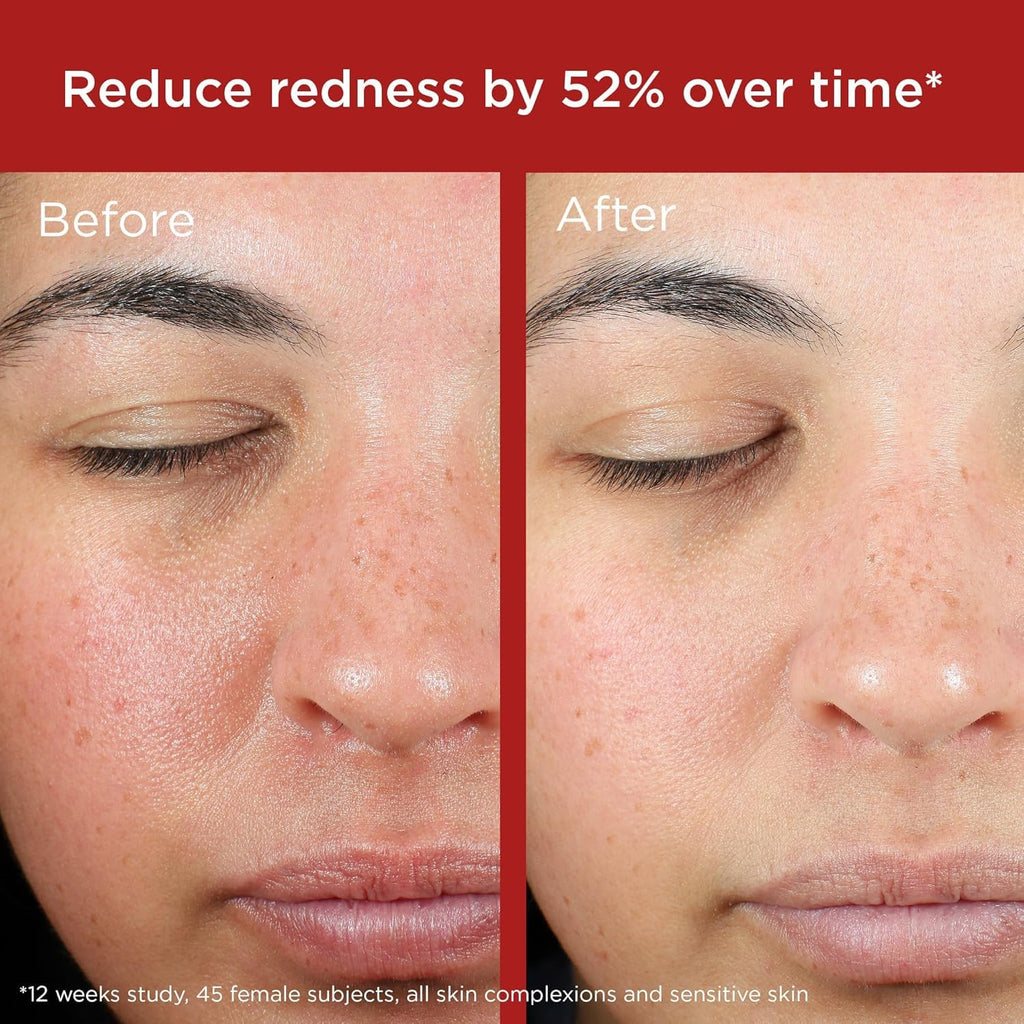 EltaMD UV Skin Recovery Sunscreen SPF 50