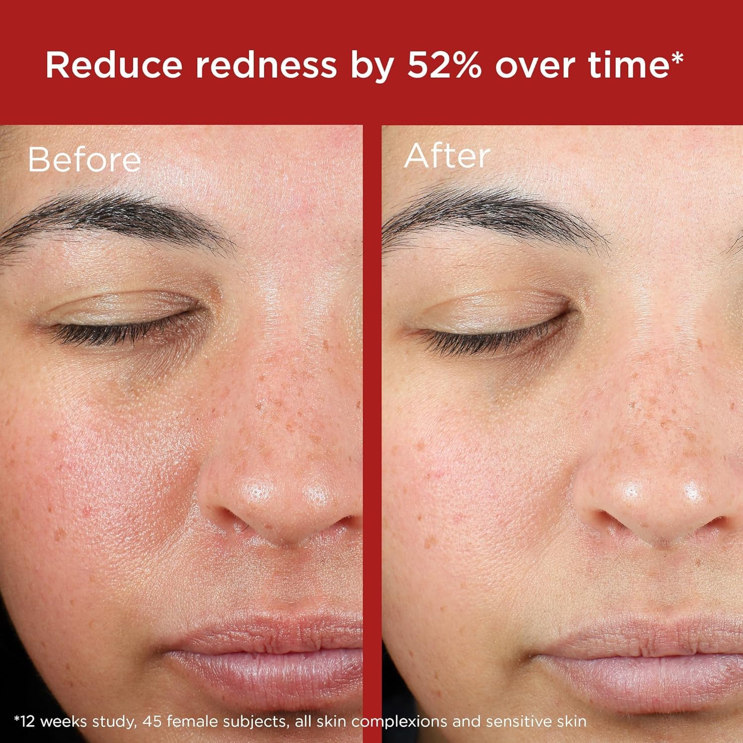 EltaMD UV Skin Recovery Sunscreen SPF 50