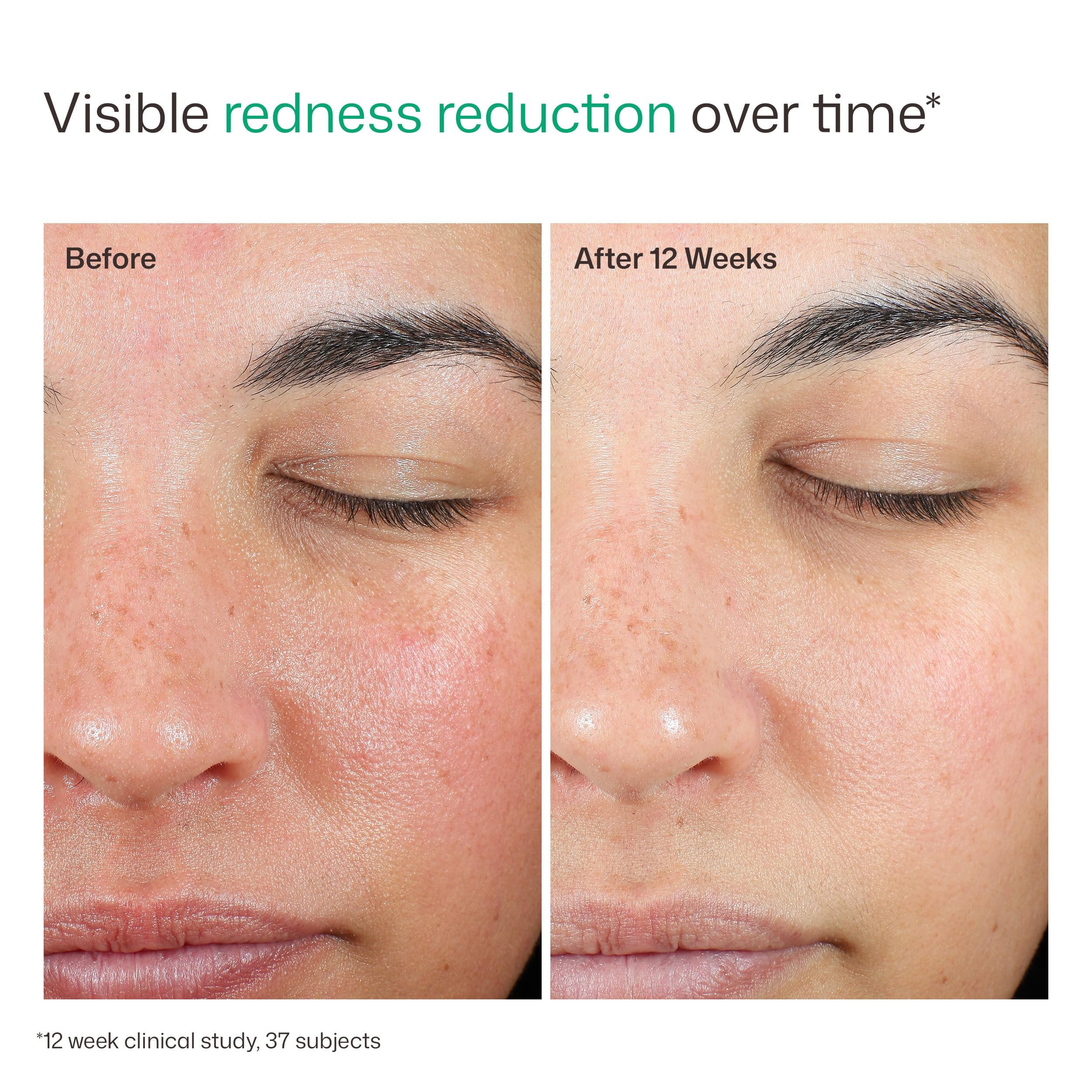 EltaMD UV Skin Recovery Sunscreen SPF 50