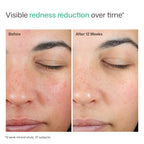 EltaMD UV Skin Recovery Sunscreen SPF 50