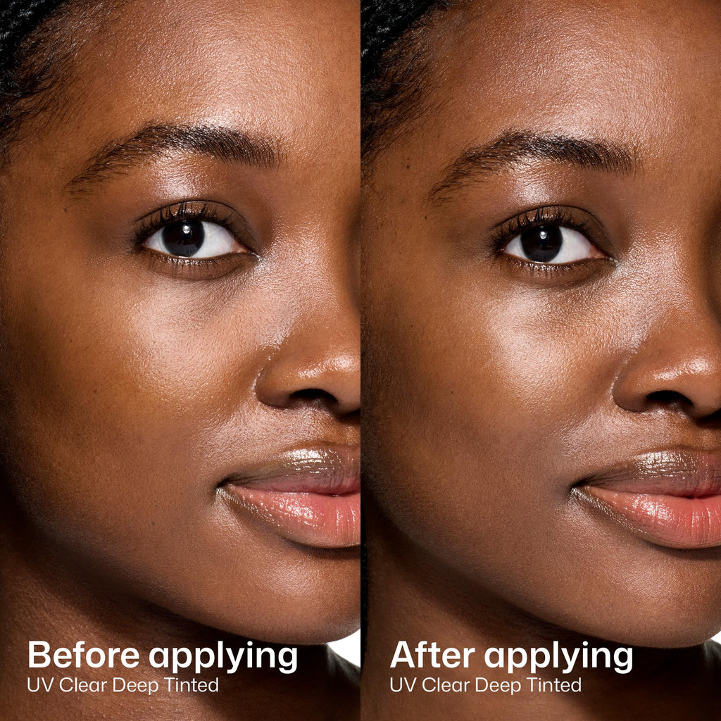 EltaMD UV Clear Face Sunscreen SPF 46