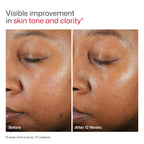 EltaMD UV Clear Face Sunscreen SPF 46