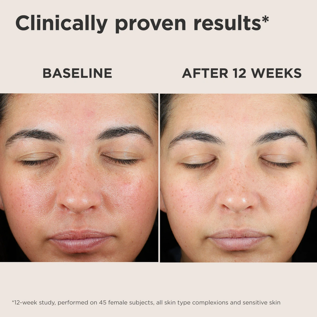 EltaMD UV Skin Recovery SPF 50