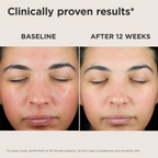 EltaMD UV Skin Recovery SPF 50